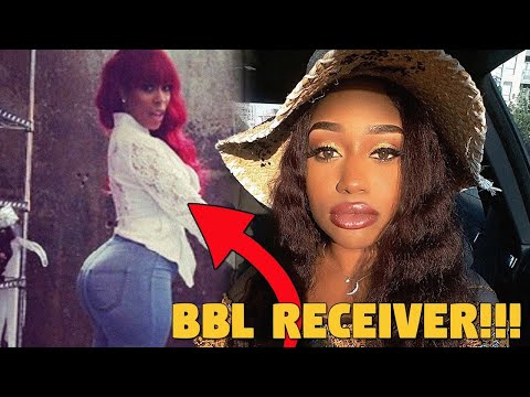 Paris Milan Asks Black Women To Stop Getting Brazilian B-U-T-T Lifts...AND HERE'S WHY SHE'S RIGHT!